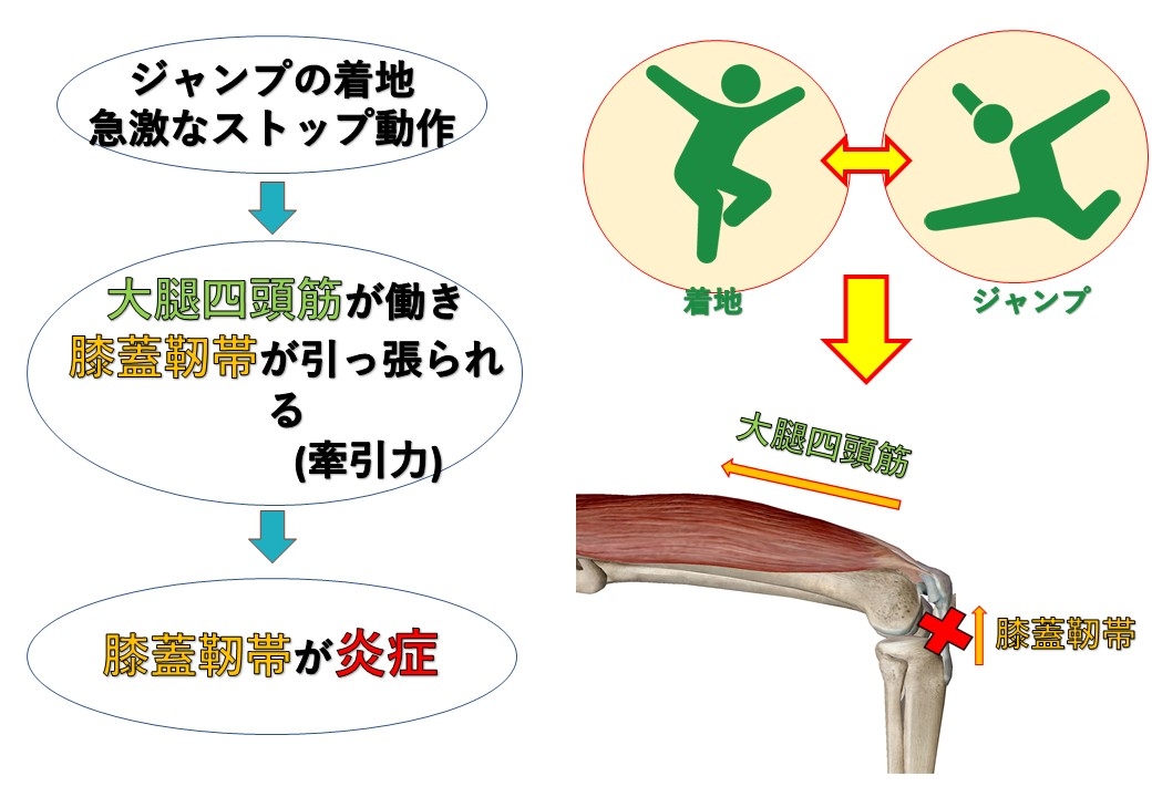 膝蓋靭帯